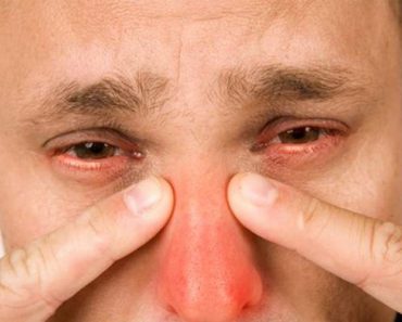 How to get rid of nasal congestion: an effective and proven way