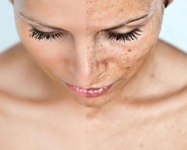 5 продуктов, которые помогут вашему организму стимулировать выработку коллагена и восстановить упругость кожи.