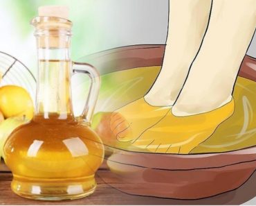 How to make an apple cider vinegar foot bath to detoxify and heal your body