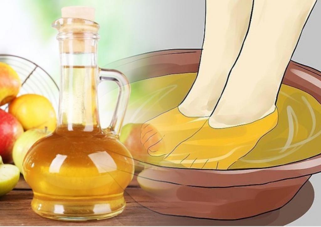 Как сделать ванну для ног с яблочным уксусом для того, чтобы вывести токсины и излечить ваше тело