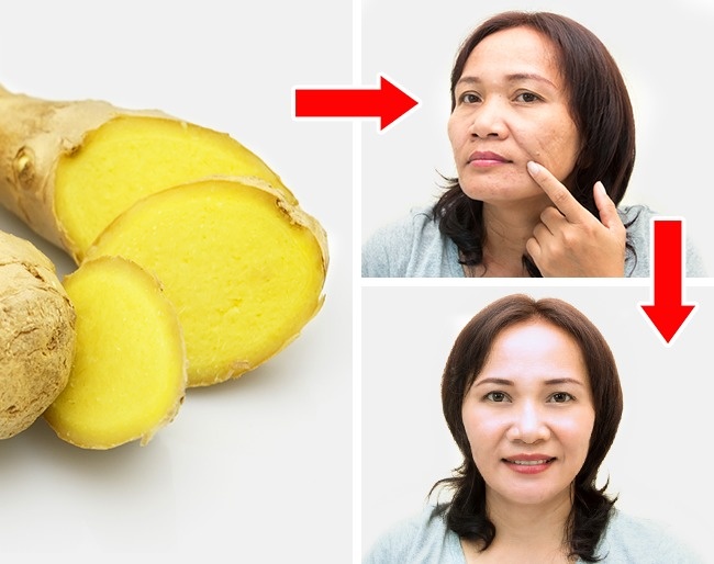 Benefits of ginger for women